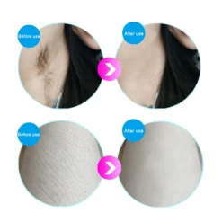 Haarentfernungsgeräte IPL Hautverjüngung Haarentferner Laserverjüngung Hair Remover Schönheitsinstrument Schmerzlos Mit Sonnenbrille -Rowesc Verkaufe 3a83b54bd62ed75d3114d601c34abd7c