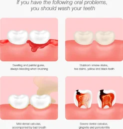 DR.BEI YC2 Ultraschall-Scaler IPX7 Wasserdichter Zahnsteinentferner Mit 3 Modi / LED-Zusatzscheinwerfer Tragbarer Wiederaufladbarer Zahnstein-Zahnsteinschaber Elektrischer Plaque-Entferner Zahnflecken-Reinigungswerkzeug Fuer Erwachsene -Rowesc Verkaufe 7d68da43f50c1051c2b62c635b5e33c2