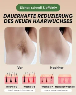 XSOUL IPL Haarentfernung Für Zuhause Für Frauen Und Männer, Dauerhafte Haarentfernung 999,999 Blitze Schmerzfreier Haarentferner Für Achseln Rücken Beine Arme Gesicht Bikinizone, Verkabelt -Rowesc Verkaufe b61696efcf181653560273e21d970e8e