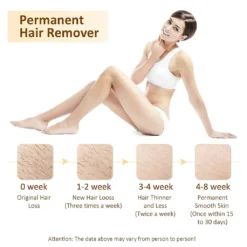 Laser-Haarentfernung, Haarentfernung Für Frauen Und Männer Dauerhafter Schmerzloser Laser-Haarentferner Mit Ice Cool, Haarentfernungsgerät Für Zu Hause Für Gesicht, Ganzen Körper(Weiß) -Rowesc Verkaufe b95e34516656b09444dd5b021ba2f3f5