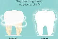 DR.BEI YC2 Ultraschall-Scaler IPX7 Wasserdichter Zahnsteinentferner Mit 3 Modi / LED-Zusatzscheinwerfer Tragbarer Wiederaufladbarer Zahnstein-Zahnsteinschaber Elektrischer Plaque-Entferner Zahnflecken-Reinigungswerkzeug Fuer Erwachsene -Rowesc Verkaufe cf85986b892b2875c1359d4450d0bc9d